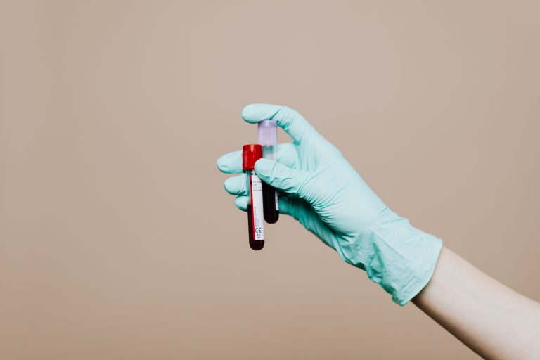 A scientist analyzing blood samples in a laboratory setting