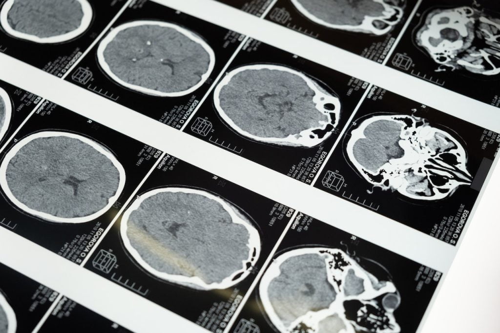 can-hybrid-intelligence-opens-up-new-opportunities-in-healthcare