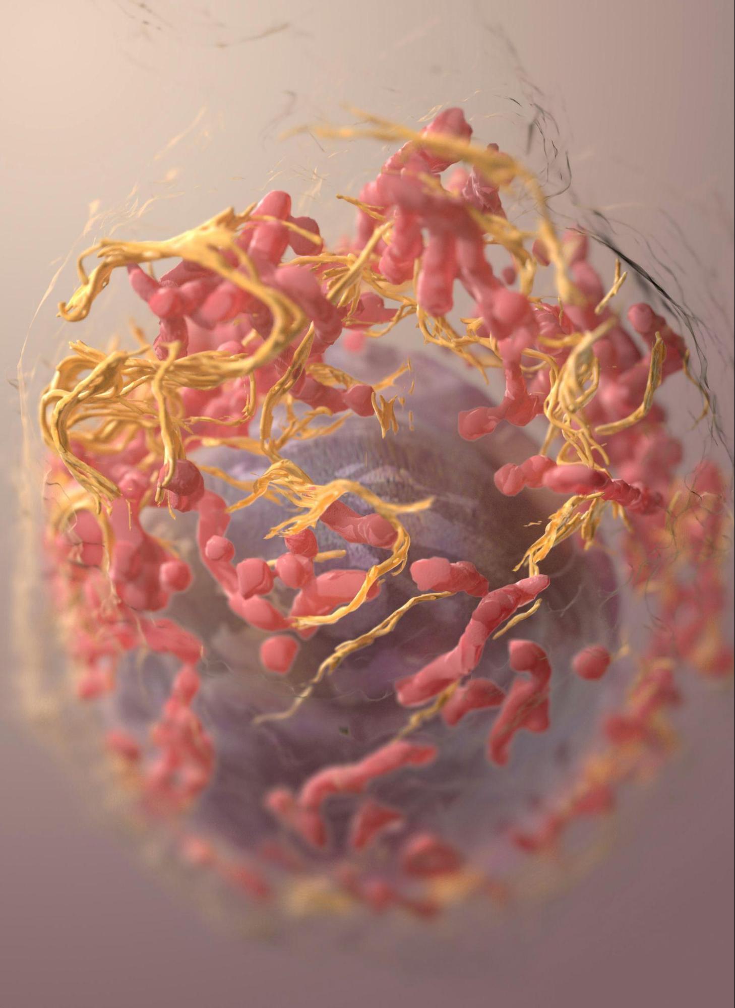 Advancing Early Detection of Melanoma Through Diagnostic Precision